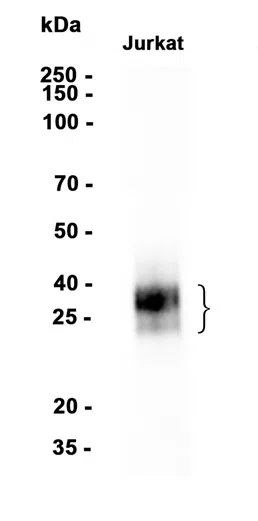 AMRe86842