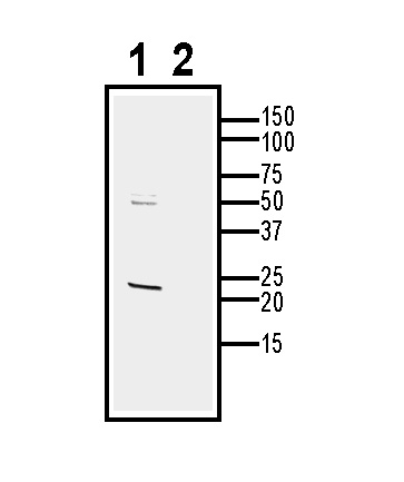 Western blot analysis of rat lung lysate: