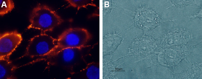 Expression of NR2A in rat C6 glioma cells