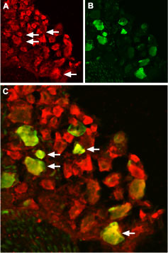 Expression of TRPV1 in rat DRG