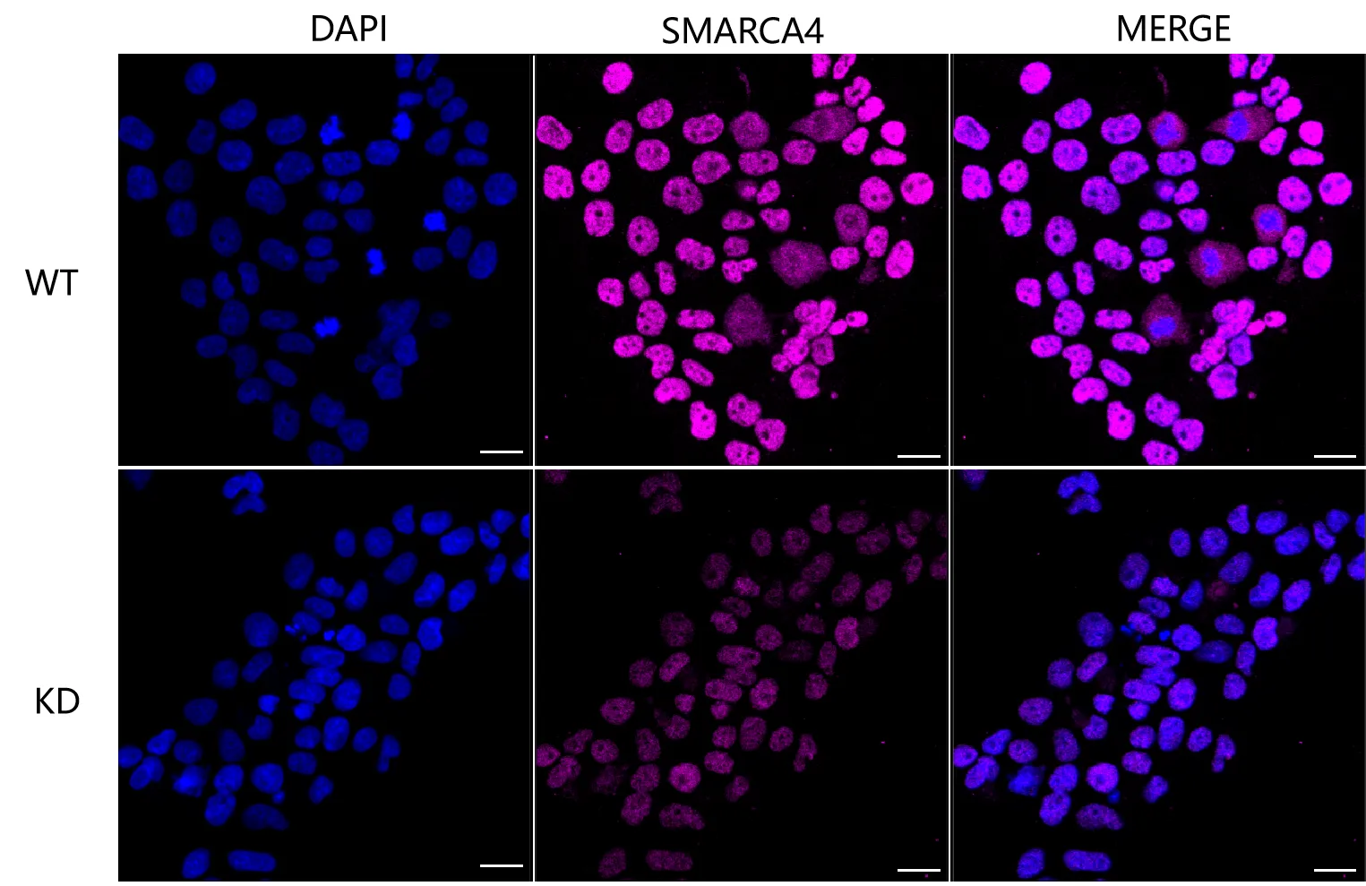 KVAb00893