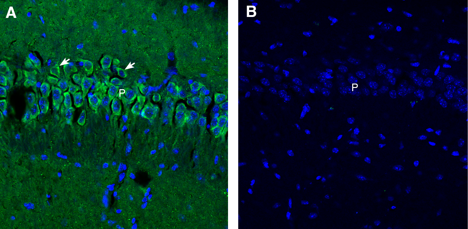 Synaptojanin 1 in mouse hippocampal CA1 region