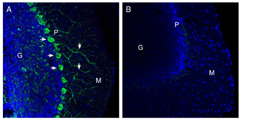 Expression of Netrin-1 in mouse cerebellum.