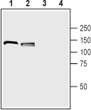 Western blot analysis of rat (lanes 1 and 3) and mouse (lanes 2 and 4) brain lysates :
