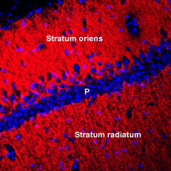 Expression of Connexin-45 in rat hippocampus