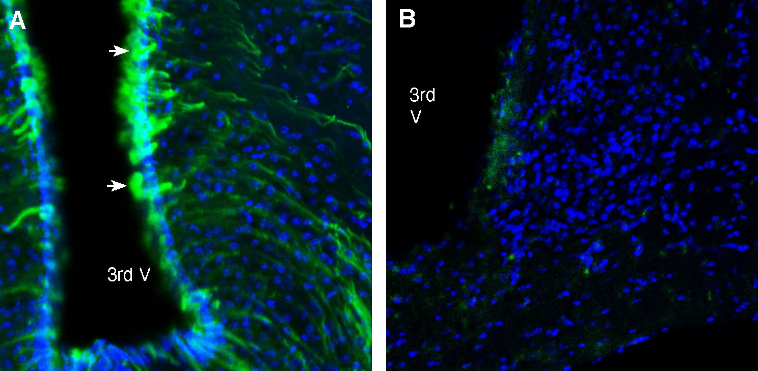 Expression of GABA(A) Receptor Beta 2 in mouse hypothalamus.