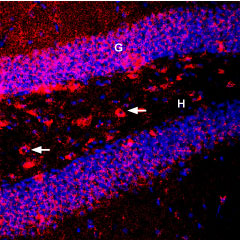 Expression of BDNF in mouse hippocampus