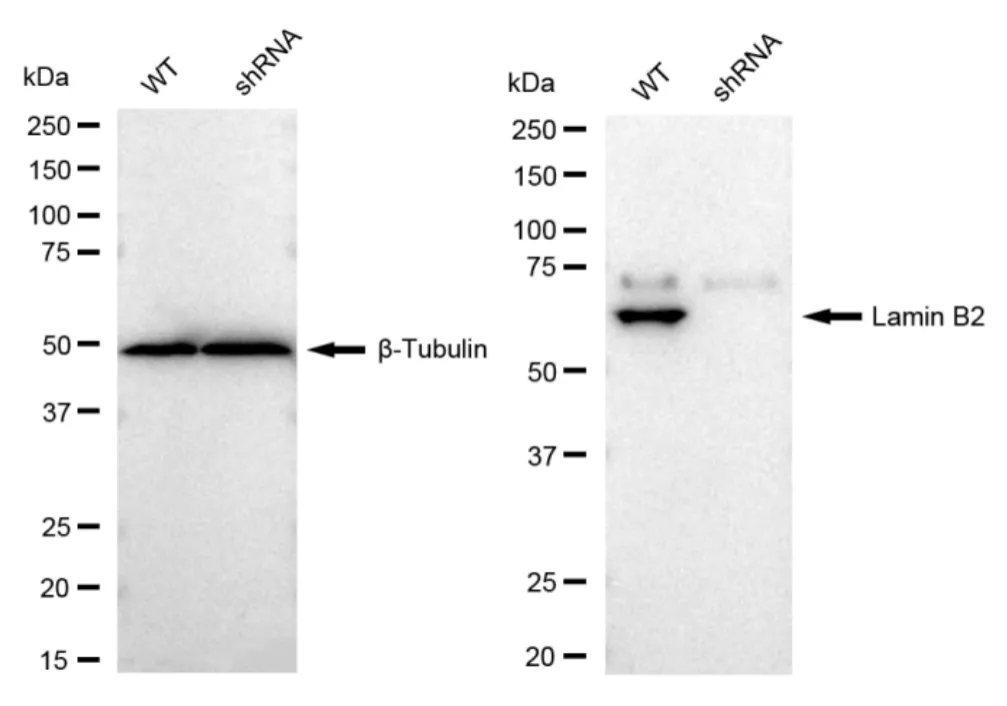 KVAb01513