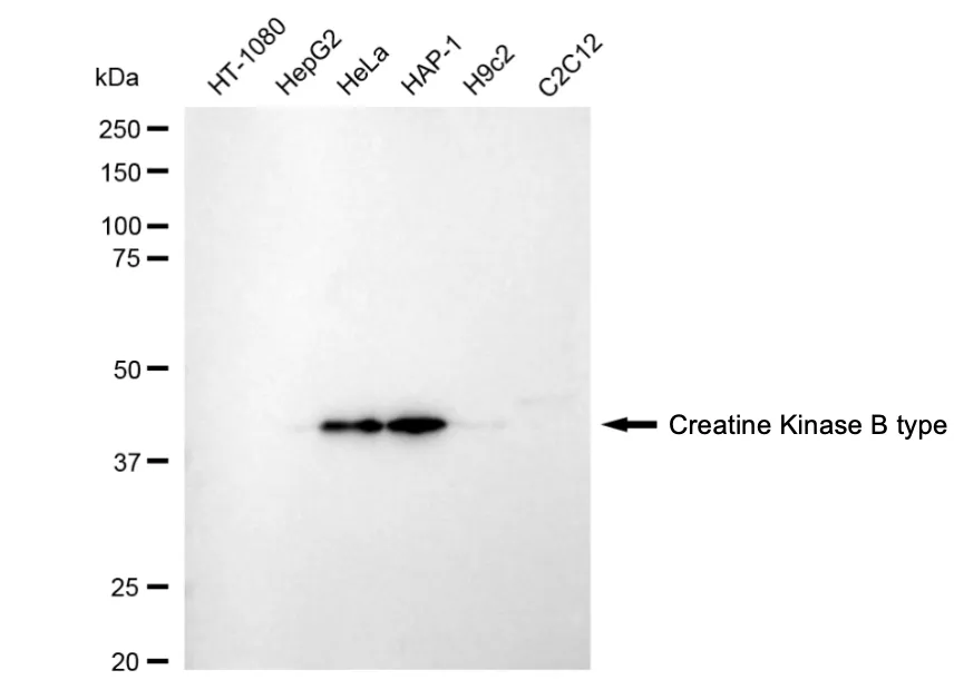 KVAb00790