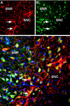 Multiplex staining of K ir 3.2 and KCNK2 in rat substantia nigra