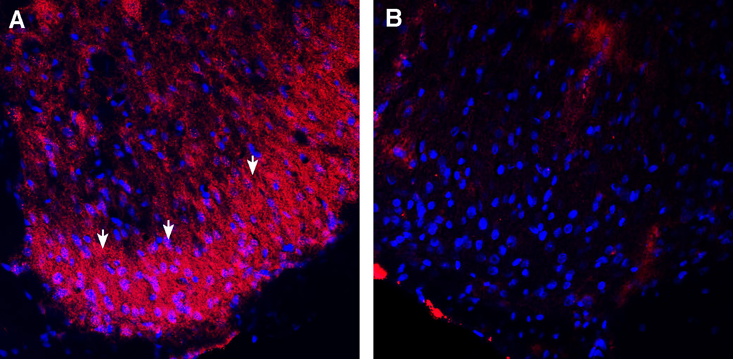 Expression of TrkB in rat spinal cord.
