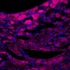 Expression of TrkA in rat dorsal root ganglion