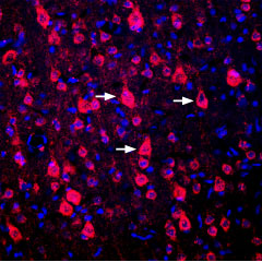 Expression of DRD1 in rat cortex