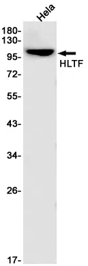 AMRe85659