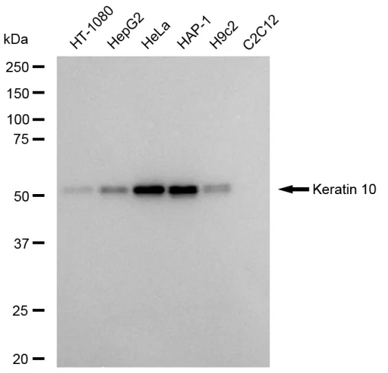 KVAb01050