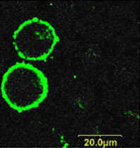 Expression of P2RX7 in human K562 cells