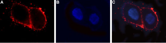 Expression of LHR in human ovary cell line