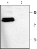Western blot analysis of rat brain membranes:
