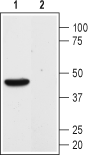 Western blot analysis of mouse kidney membranes: