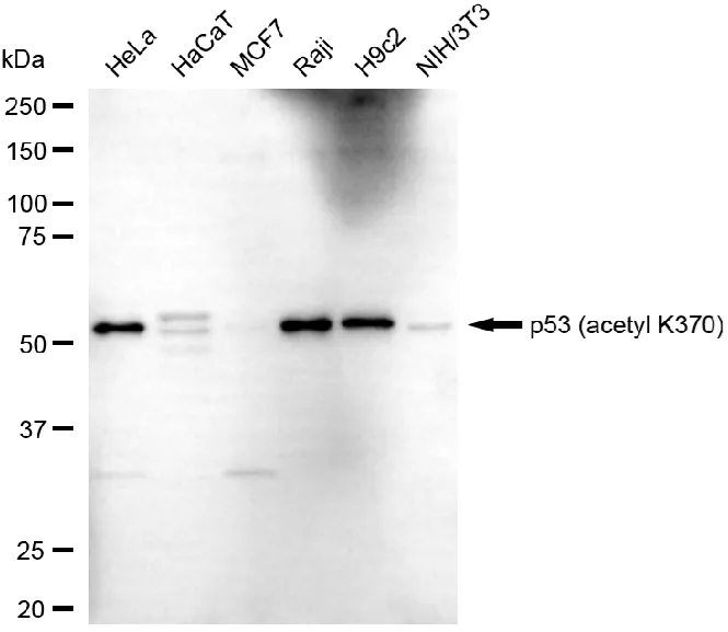 KVAb00096