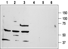 Western blot analysis of human promyelocytic leukemia HL-60 (lanes 1 and 4), human T-cell leukemia Jurkat (lanes 2 and 5), and chronic myelogenous leukemia K562 (lanes 3 and 6) cell line lysates: