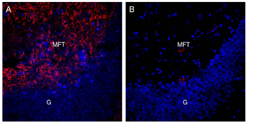 Expression of Alpha-Synuclein in rat hippocampus.