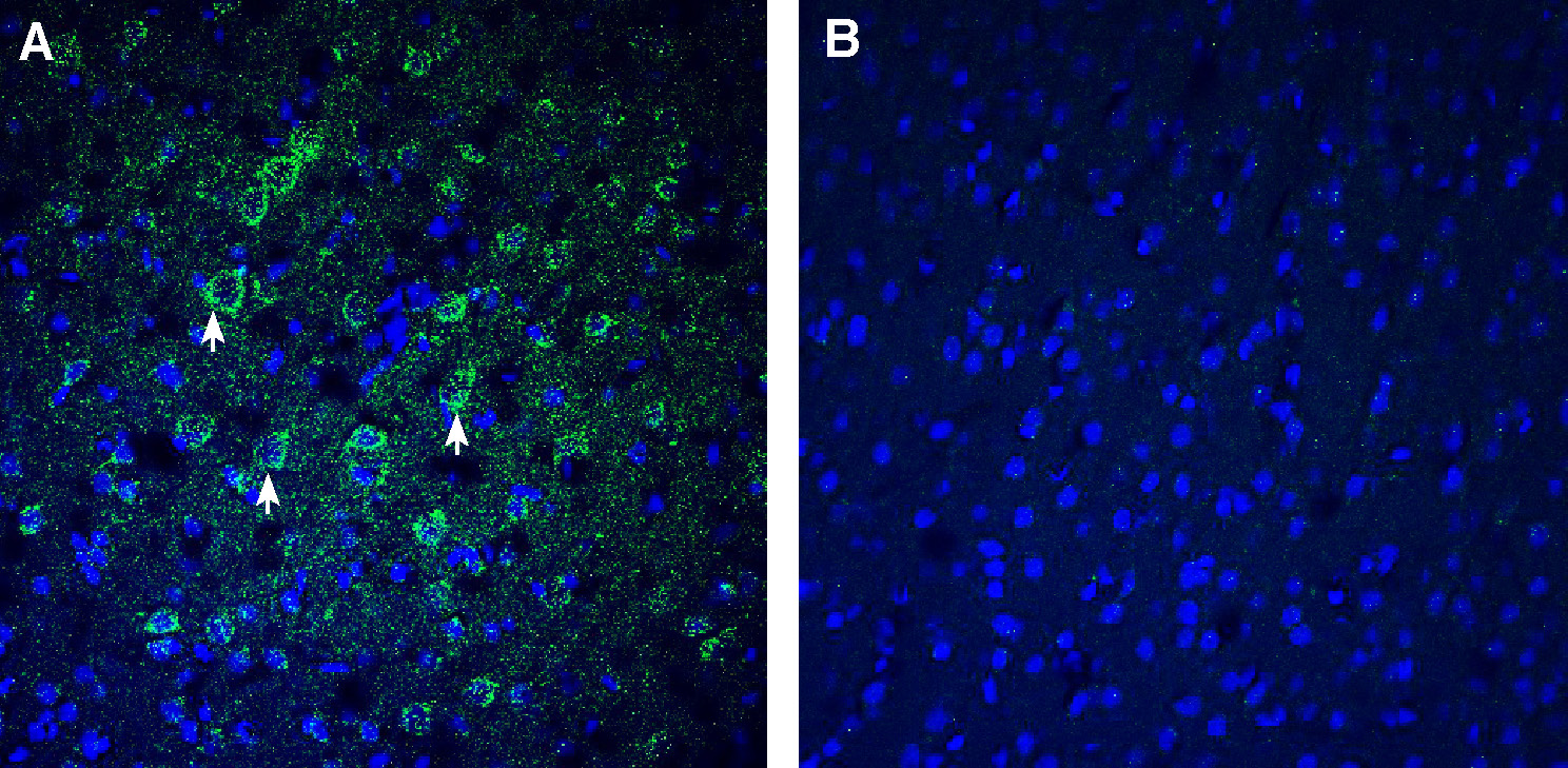 Expression of TMEM106B in mouse cortex.