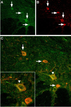 Expression of TRPV3 in mouse spinal cord