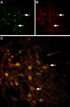 Multiplex staining of VMAT2 and TRPC3 in rat brain