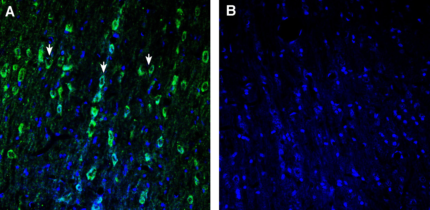 Expression of TMEM175 in rat medial septum.