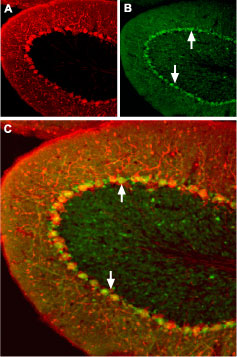 Expression of Angiotensin II Receptor Type-1 in mouse cerebellum