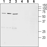 Western blot analysis of rat brain (lanes 1 and 4), mouse brain (lanes 2 and 5) and rat brain stem (lanes 3 and 6) lysates :
