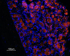 Expression of Prokineticin receptor 1 in rat DRG